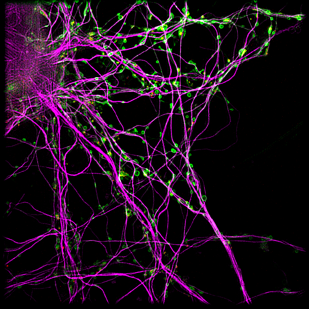 Structured Illumination Microscopy reveals the microtubules (magenta) and lysosomes (green) in neurons.