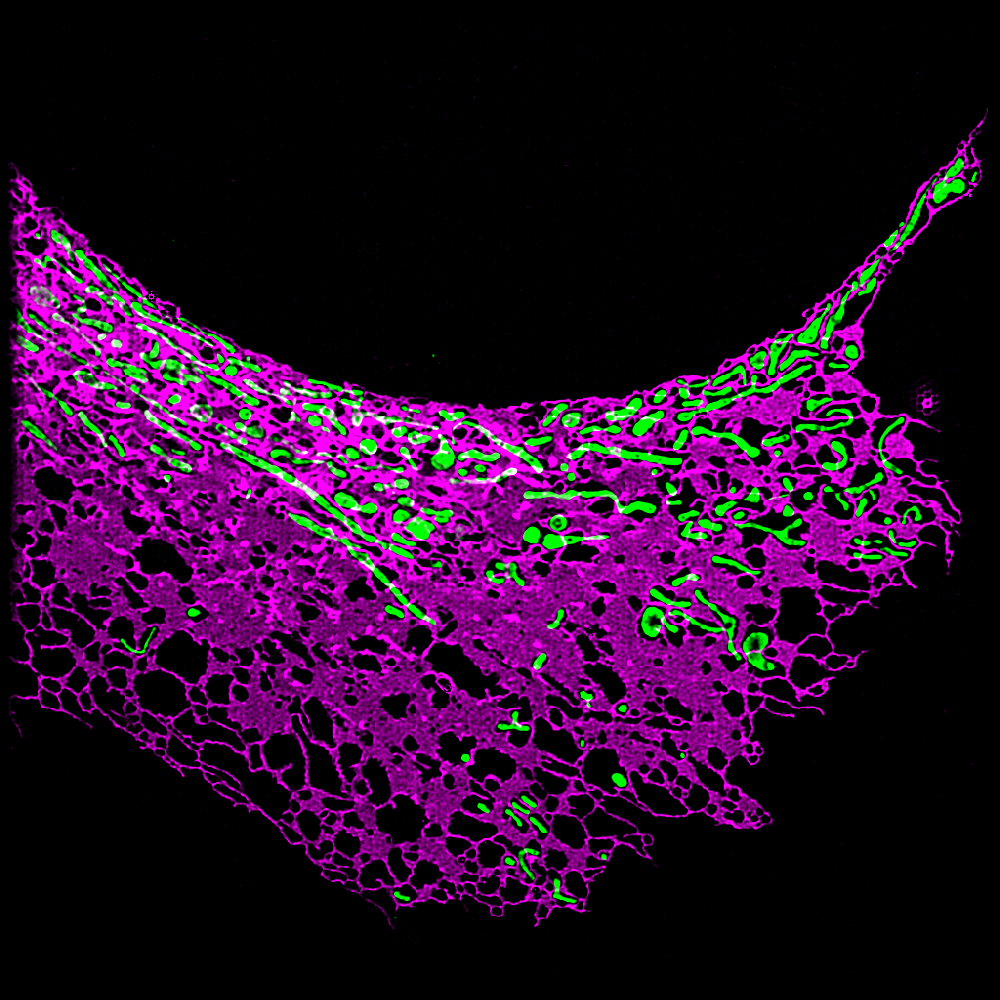 Structured Illumination Microscopy reveals the ER and mitochondria in a COS-7 cell.