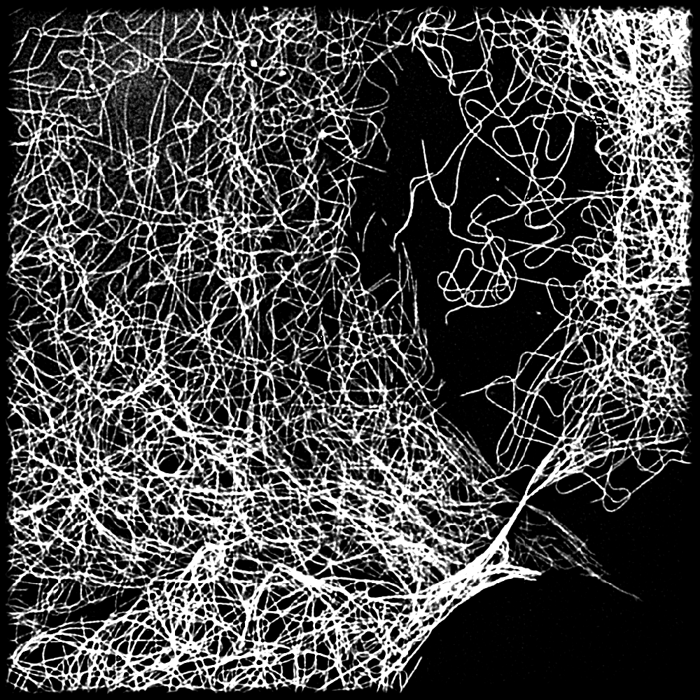 microtubules in COS-7 cell revealed by SIM