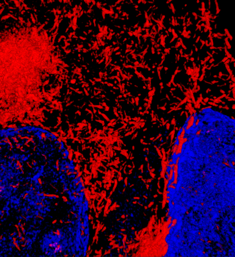 in situ amyloid beta revealed by 3D SIM